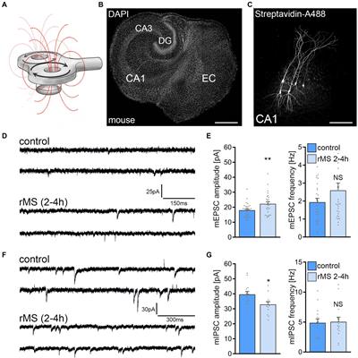 Axon morphology and intrinsic cellular properties determine repetitive transcranial magnetic stimulation threshold for plasticity